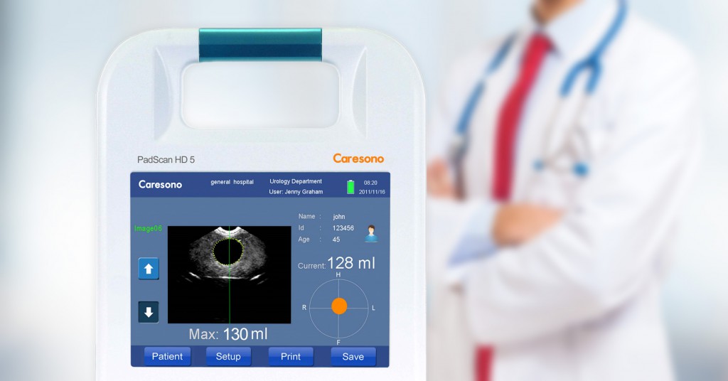 Caresono Blöðruskanni HD5